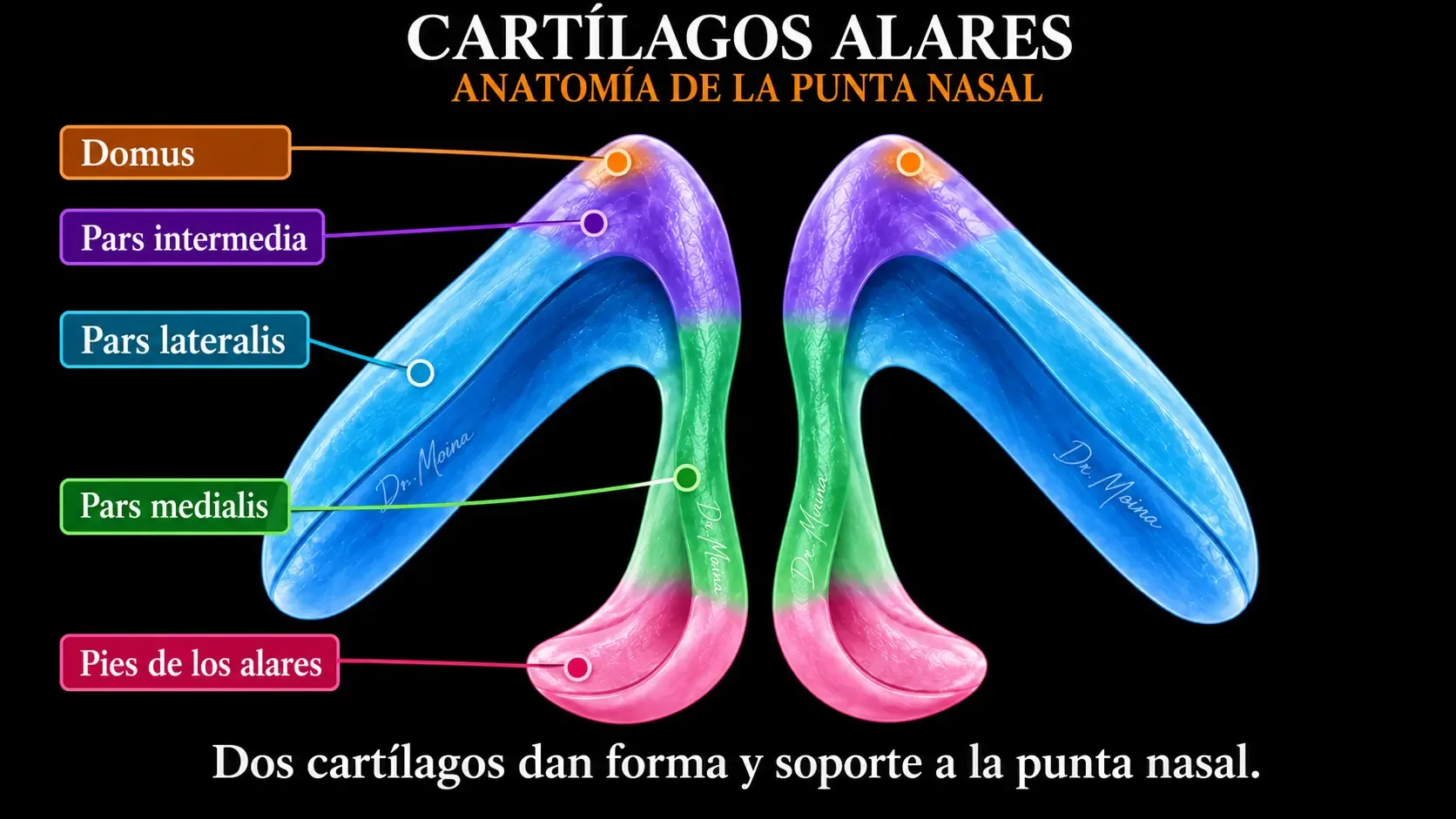 Esquema de los cartílagos alares con domus, pars intermedia, pars lateralis, pars medialis y pies de los alares señalados por colores