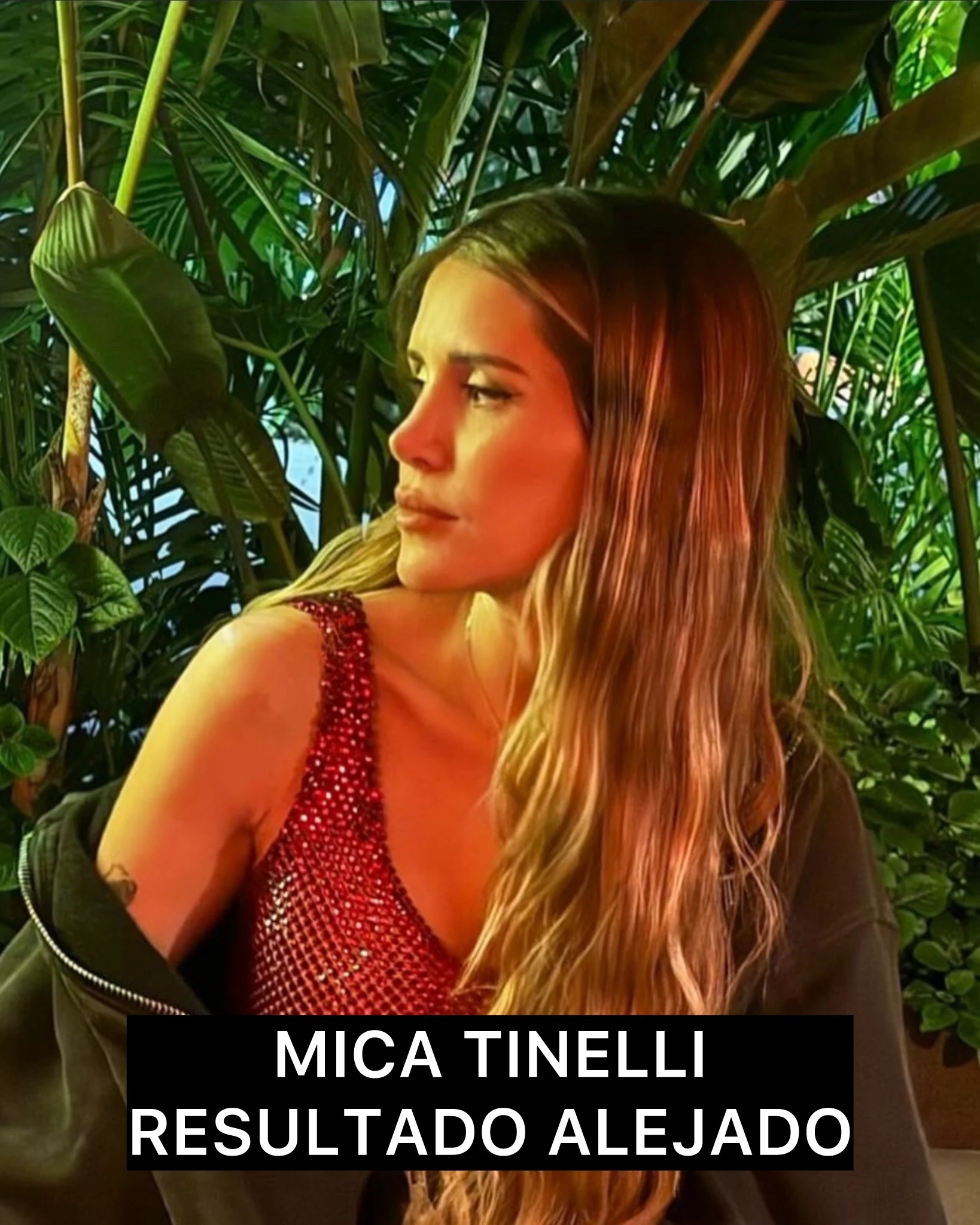 Micaela Tinelli, fotografía de resultado alejado de rinoplastia compartida por la paciente.