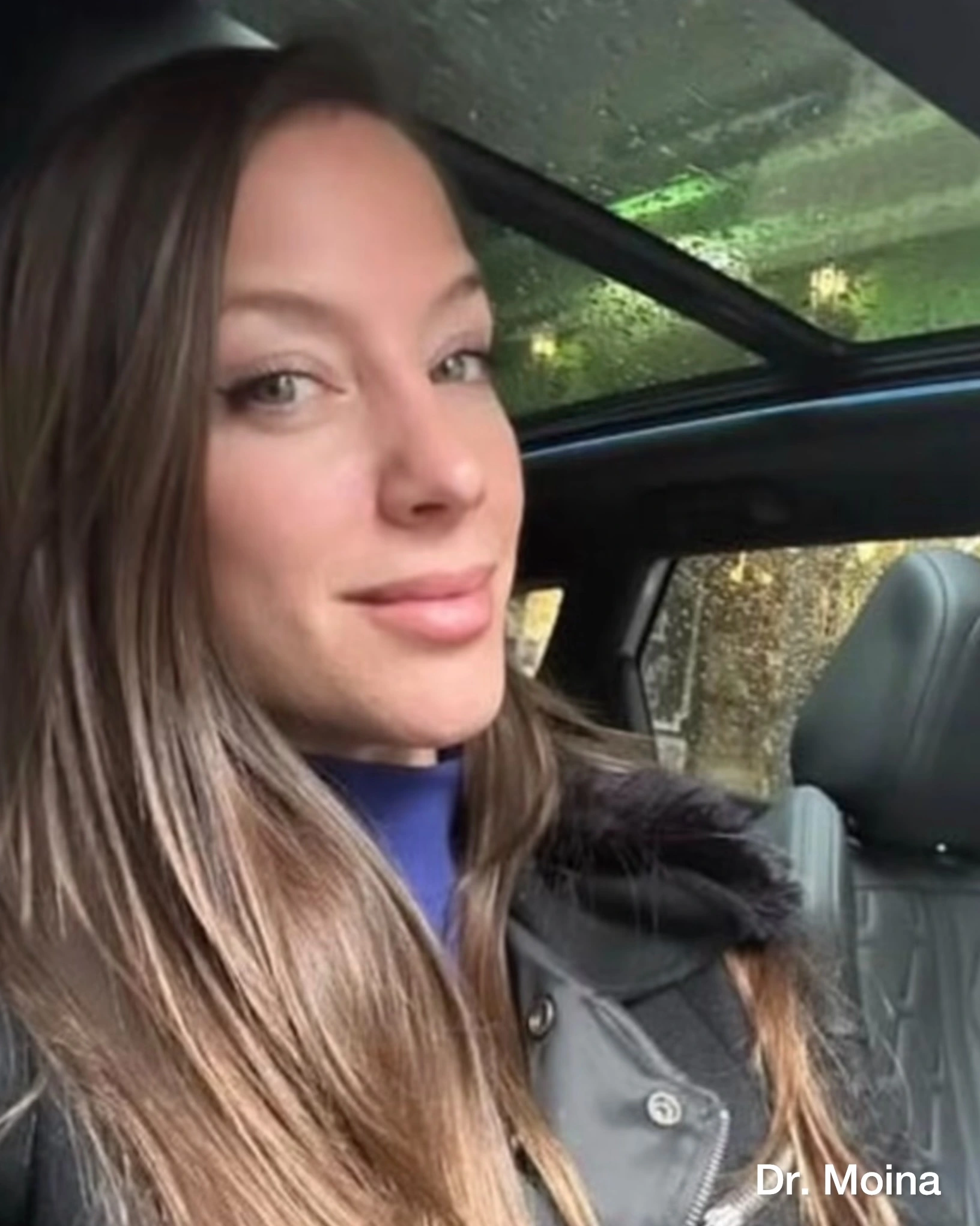Alexandra comparte una fotografía de su resultado alejado de rinoplastia, realizada en un entorno cotidiano.